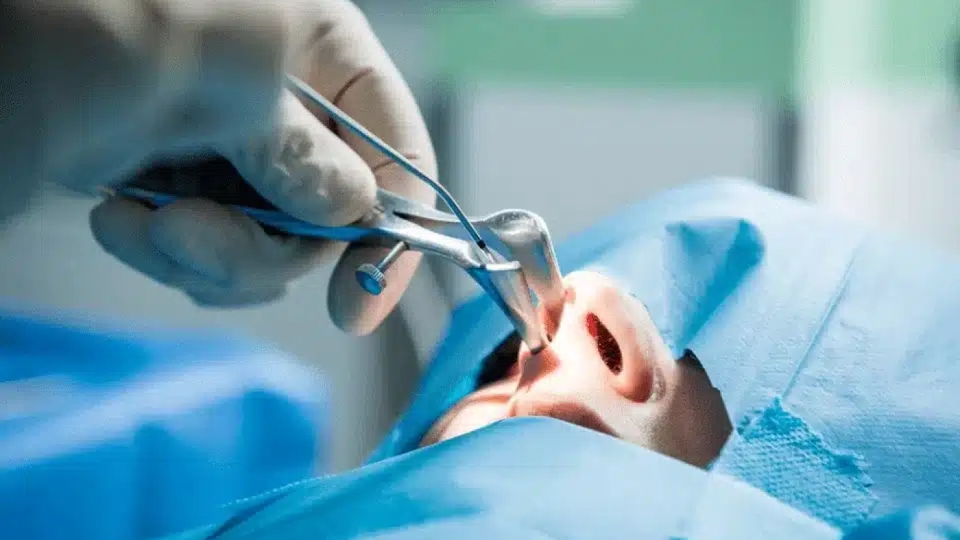 Fonksiyonel Endoskopik Sinüs Cerrahisi ile kronik sinüzit tedavi süreci