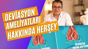 Deviasyon Ameliyatı ve Süreçleri Hakkında Bilgilendirme