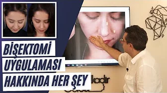 Hollywood yanağı için bişektomi uygulaması ve yüz estetiği hakkında bilgi veren video.